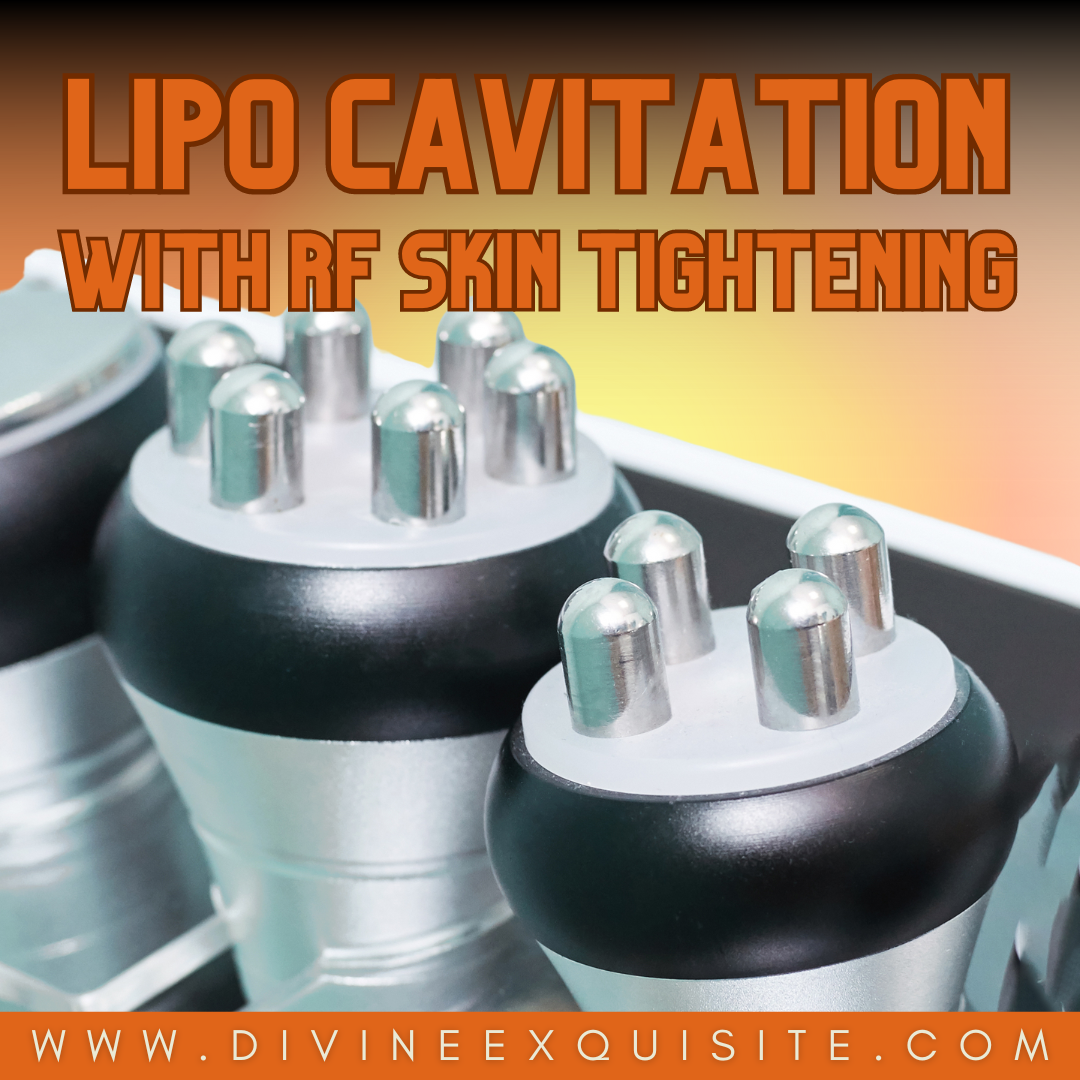 Lipo Cavitation and RF Skin Tightening