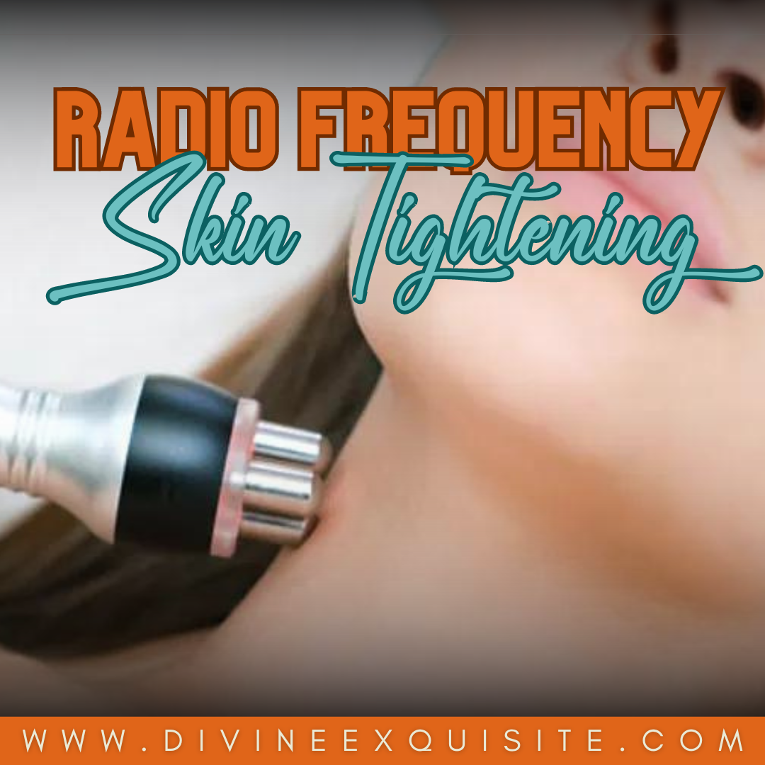 Radio Frequency (RF) Skin Tightening